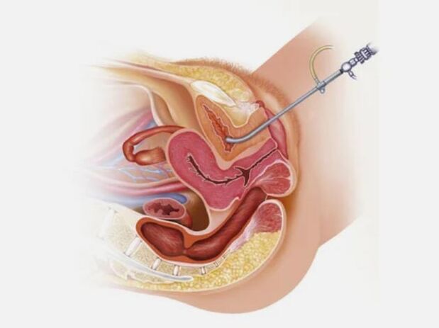 Zystitisdiagnose