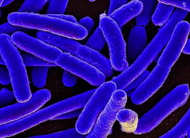 E. coli verursacht am häufigsten die Entwicklung einer Blasenentzündung bei Frauen. 